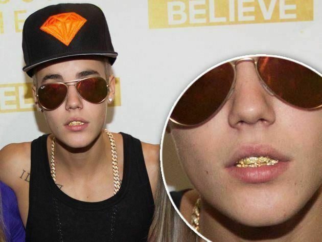 HarlemBling 14k Gold Over Real SOLID 925 Silver Diamond GRILLZ Teeth Top Bottom Hip Hop ICY