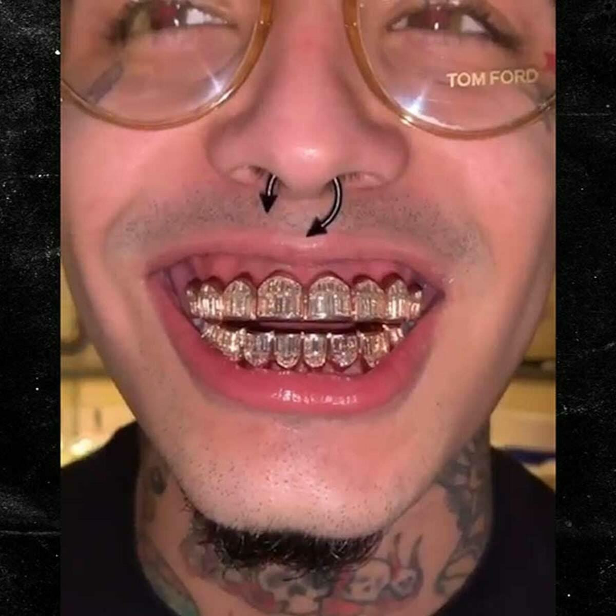 HarlemBling Real 14k Gold Over Solid 925 Silver Grillz Baguette Iced Grills Top Bottom Teeth
