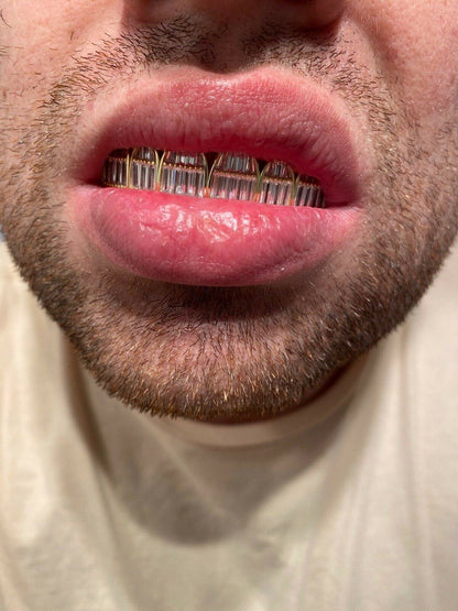 HarlemBling Real 14k Gold Over Solid 925 Silver Grillz Baguette Iced Grills Top Bottom Teeth