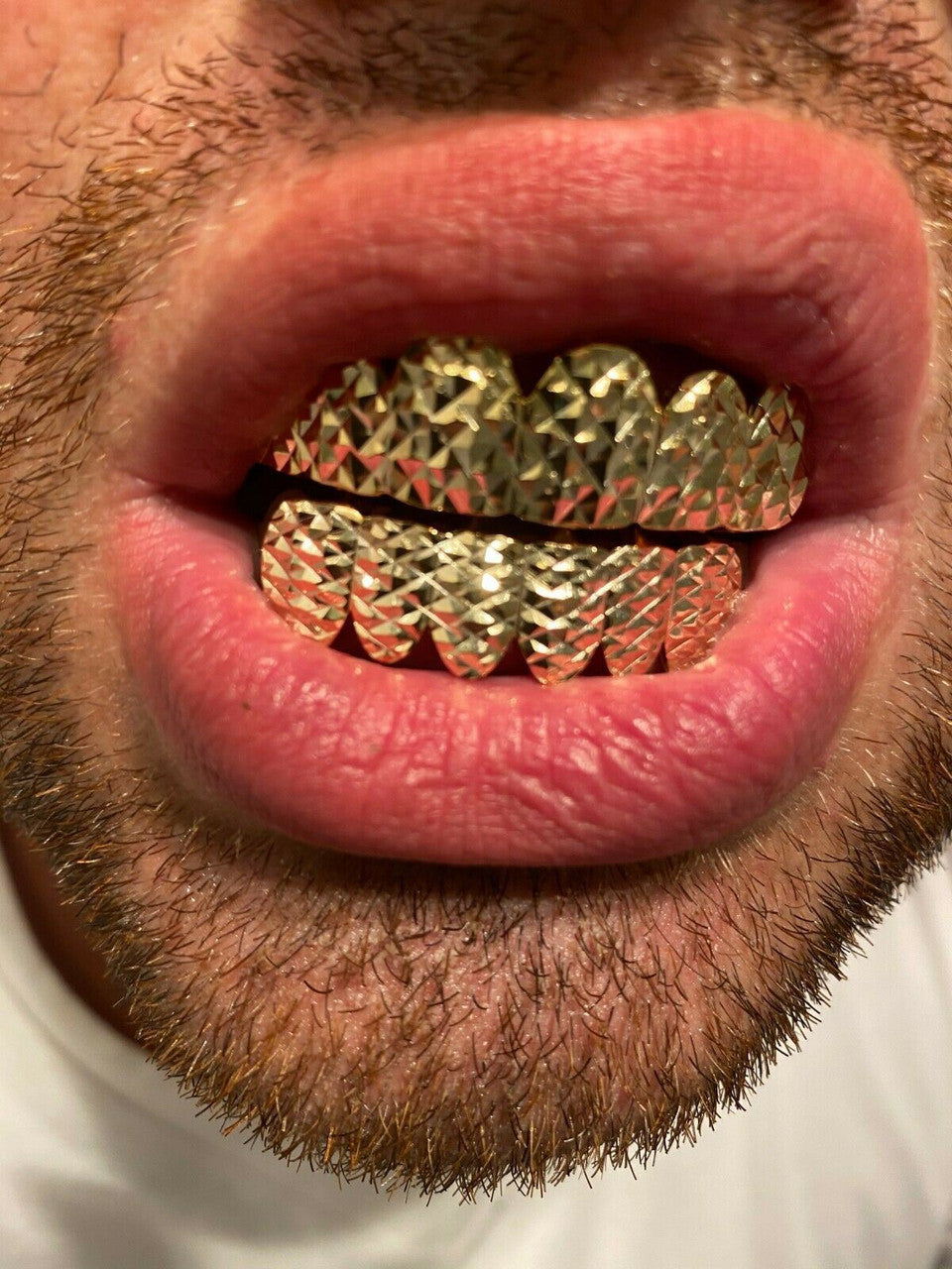 HarlemBling REAL 14k Gold Over Solid 925 Sterling Silver Diamond Cut Grillz Teeth Fronts