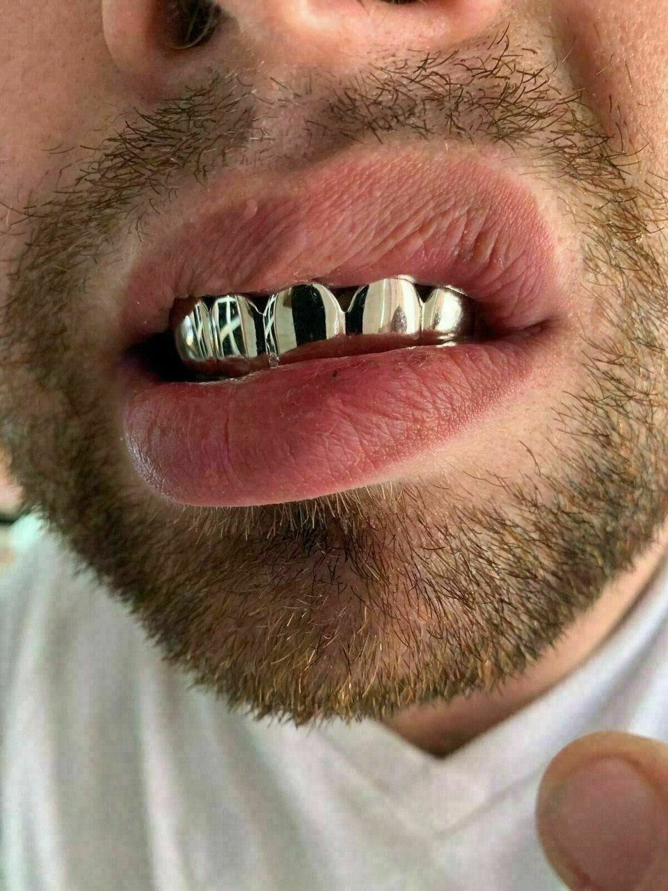 HarlemBling Real 925 Sterling Silver - GRILLZ Top Bottom Hip Hop Grills 6 8 Or Single Teeth