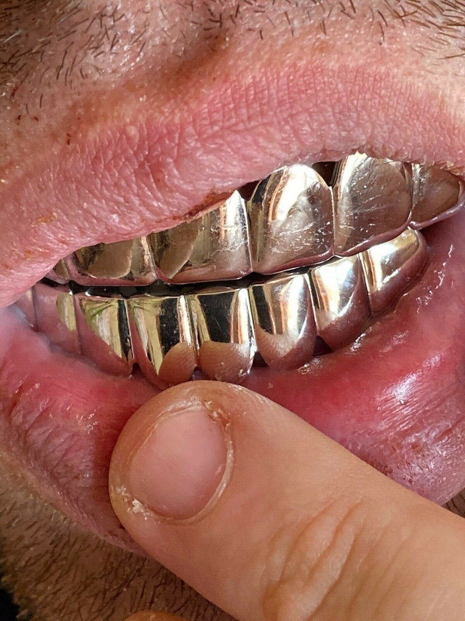 HarlemBling Real 925 Sterling Silver - GRILLZ Top Bottom Hip Hop Grills 6 8 Or Single Teeth