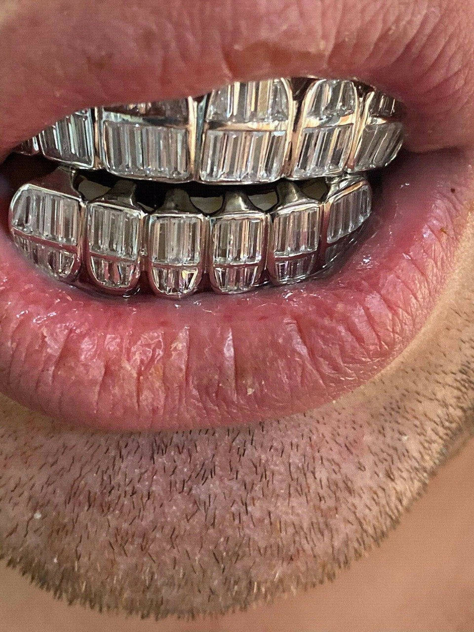 HarlemBling Real 925 Sterling Silver ICED Diamond Baguette GRILLZ Teeth Top and Bottom Set ICY