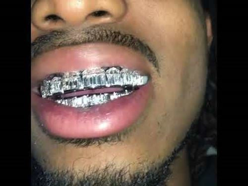 HarlemBling Real Solid 925 Sterling Silver Grillz Baguette Iced Grills Top Or Bottom Teeth