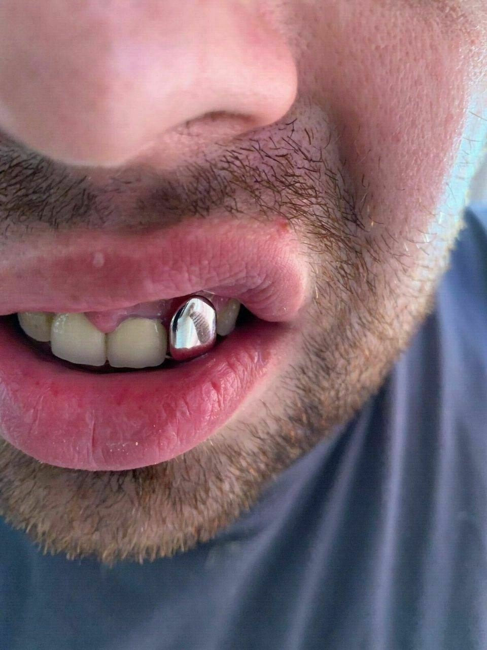 HarlemBling Solid 925 Sterling Silver Single Tooth Grillz Real Custom Hip Hop Grills Caps